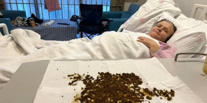 Safra kesesinden 20 binin üzerinde taş çıkarıldı