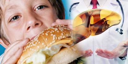 Sivas'tan ailelere uyarı! Çocuklarda karaciğer yağlanmasına dikkat