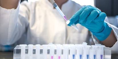 2024'te 1,3 milyon kişi AIDS'e yakalandı