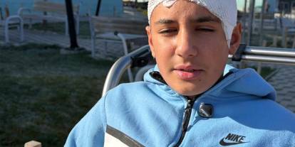 Akran zorbalığına maruz kalan çocuğun kafatası titanyumla tedavi edildi