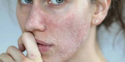 Sivas’ta kış sert geçiyor, cilt alarm veriyor