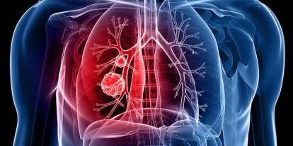 Sivas Verem Savaş Dispanserinden hayati çağrı!