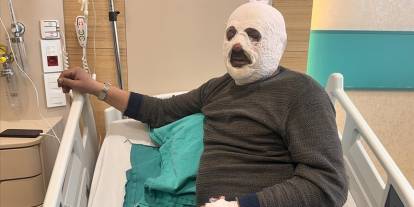 Kalorifer kazanını yakmak için döktüğü benzin az daha canından ediyordu