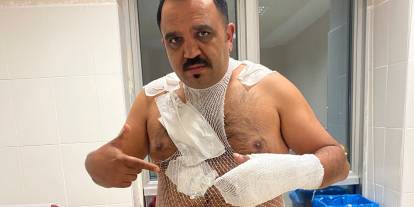 Meşhur tostçu, soğuk havada şov yapmak isterken kendini yaktı