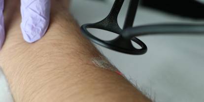 Estetik lazer uygulamalarında en doğru zaman