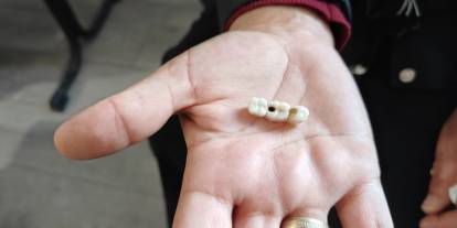 İmplant elinde hasta şikayette