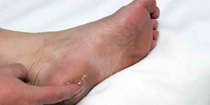 Uzmanından topuk dikeni uyarısı