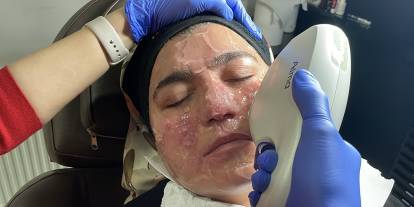 Yıllarca evden çıkamıyordu... Dermanı Sivas'ta buldu