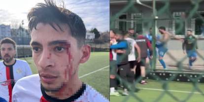 Maç sonrası saha içi savaş alanına döndü, 3 futbolcu hastanelik oldu