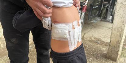 Eşek, 5 yaşındaki çocuğa saldırdı