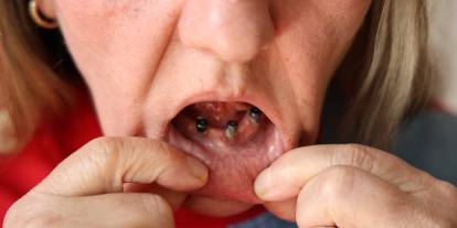 Sivas’ta skandal iddia! Hastaneye gitti, 25 dişini kaybetti!